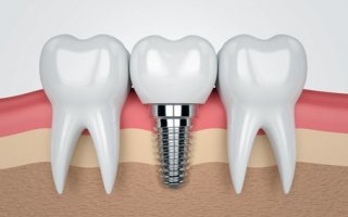 Laboratuvar Ortamında Büyüyen Dişler Gerçek Olabilir mi?